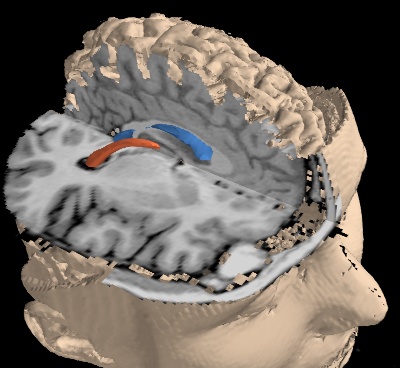 ../_images/example_mri.jpg