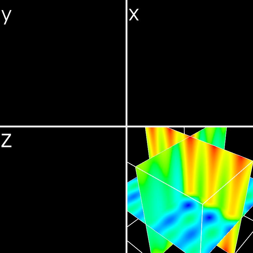 ../_images/example_volume_slicer_advanced.jpg